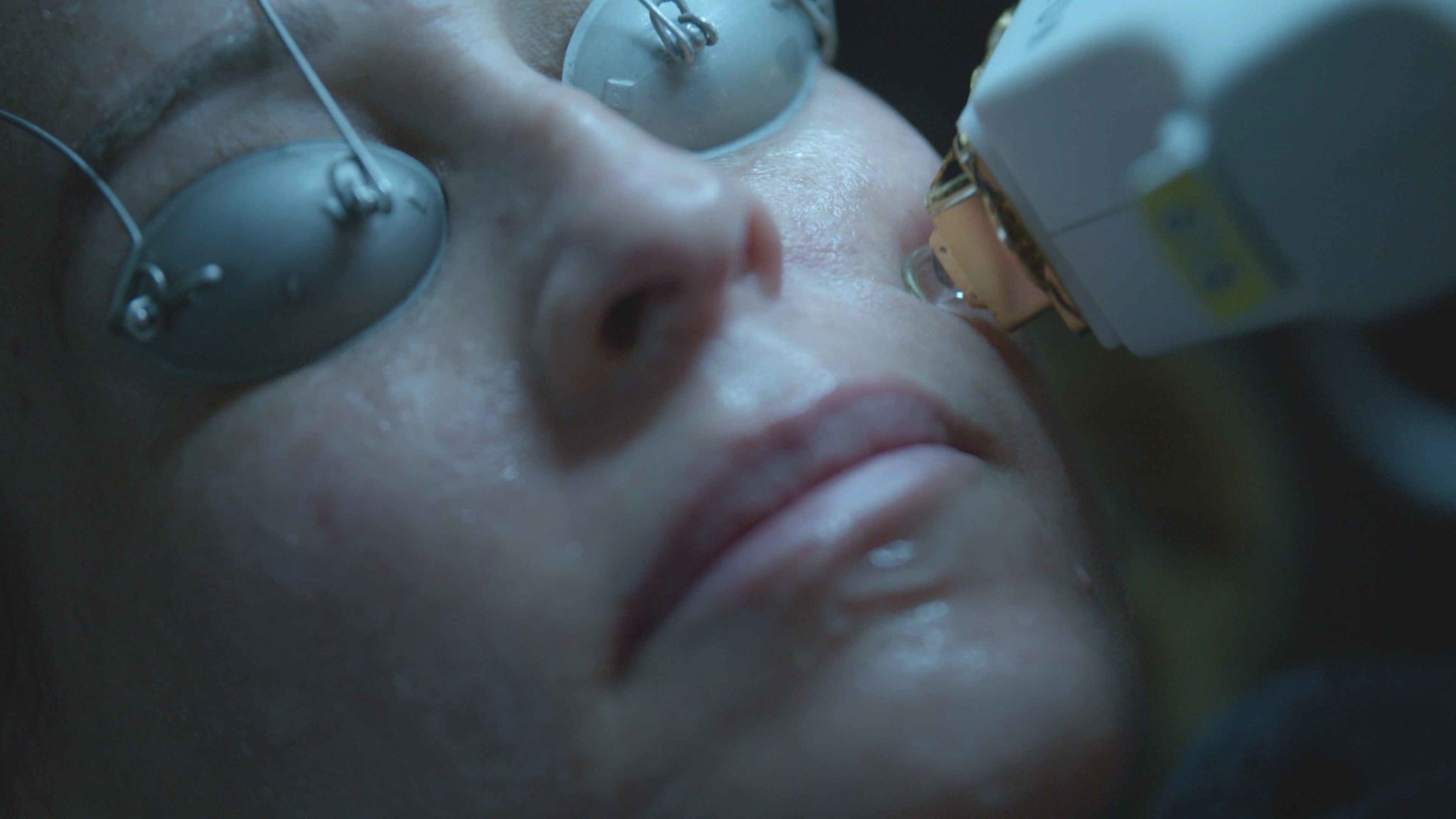 Glo Laser By GloDerma Aesthetics in Yardley, PA